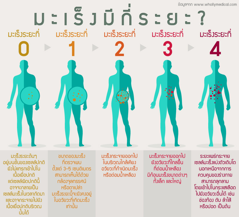สั่งซื้อผลิตภัณฑ์เสริมอาหาร CA สมุนไพรเพื่อผู้ป่วยมะเร็ง สมุนไพรรักษามะเร็ง สมุนไพรต้านมะเร็ง