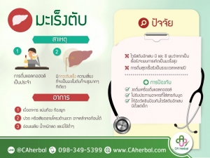 มะเร็งตับ